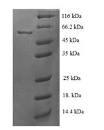 Recombinant Human Steroid 21-hydroxylase (CYP21A2)