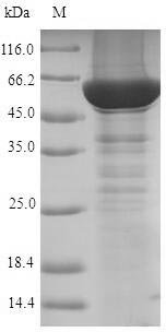 Recombinant Human Steroid 21-hydroxylase (CYP21A2), Homo sapiens (Human), Yeast, N-terminal 6xHis-tagged, 57.9kDa, purity >90% as determined by SDS-PAGE.