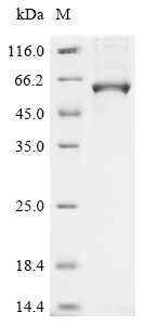 Recombinant Human Cytochrome P450 26B1 (CYP26B1), Homo sapiens (Human), E.coli, N-terminal 6xHis-tagged, 63.5kDa, purity >90% as determined by SDS-PAGE.