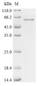 Recombinant Human Cytochrome P450 2J2 (CYP2J2)