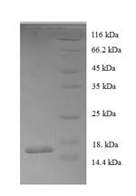 Recombinant Human Acyl-CoA-binding protein (DBI), Homo sapiens (Human), E.coli, N-terminal 6xHis-tagged, 15.7kDa, purity >90% as determined by SDS-PAGE.