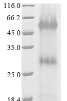 (Tris-Glycine gel) Discontinuous SDS-PAGE (reduced) with 5% enrichment gel and 15% separation gel.
