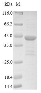 Recombinant Human N (G),N (G)-dimethylarginine dimethylaminohydrolase 1 (DDAH1), Homo sapiens (Human), E.coli, N-terminal 10xHis-tagged and C-terminal Myc-tagged, 38.4kDa, purity >85% as determined by SDS-PAGE.