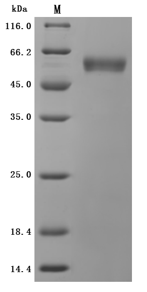Recombinant Human Epithelial discoidin domain-containing receptor 1 (DDR1), partial (Active), Homo sapiens (Human), Mammalian cell, C-terminal 10xHis-tagged, 46.8kDa, purity >95% as determined by SDS-PAGE.