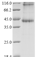 (Tris-Glycine gel) Discontinuous SDS-PAGE (reduced) with 5% enrichment gel and 15% separation gel.