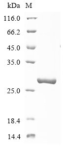 Recombinant Human Probable ATP-dependent RNA helicase DDX60 (DDX60), partial, Homo sapiens (Human), E.coli, N-terminal 10xHis-tagged and C-terminal Myc-tagged, 26.5kDa, purity >90% as determined by SDS-PAGE.
