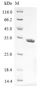 Recombinant Human Probable ATP-dependent RNA helicase DDX60 (DDX60), partial