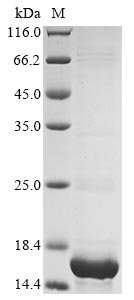 Recombinant Human Protein DEK (DEK) (S375SLEH), partial