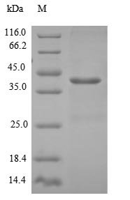 Recombinant Human Density-regulated protein (DENR), Homo sapiens (Human), E.coli, N-terminal 6xHis-SUMO-tagged, 38.0kDa, purity >90% as determined by SDS-PAGE.