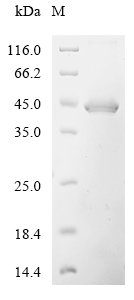 Recombinant Human Desert hedgehog protein (DHH), partial