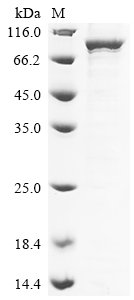 Recombinant Human Putative ATP-dependent RNA helicase DHX33 (DHX33), Homo sapiens (Human), E.coli, N-terminal 10xHis-tagged and C-terminal Myc-tagged, 86.3kDa, purity >85% as determined by SDS-PAGE.