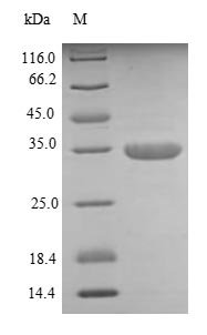 Recombinant Human Dickkopf-related protein 1 (DKK1), partial