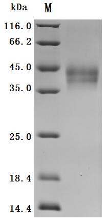Recombinant Human Dickkopf-related protein 1 (DKK1) (Active), Homo sapiens (Human), Mammalian cell, C-terminal 10xHis-tagged, 28.5kDa, purity >95% as determined by SDS-PAGE.