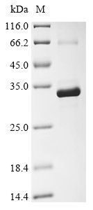 Recombinant Human Dickkopf-related protein 4 (DKK4)