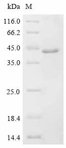 Recombinant Human Dickkopf-related protein 4 (DKK4)
