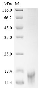 Recombinant Human Delta-like protein 3 (DLL3), partial (Active)