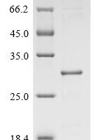 (Tris-Glycine gel) Discontinuous SDS-PAGE (reduced) with 5% enrichment gel and 15% separation gel.