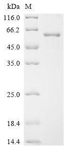 Recombinant Human DNA replication ATP-dependent helicase/nuclease DNA2 (DNA2), partial, Homo sapiens (Human), E.coli, C-terminal 6xHis-tagged, 57.3kDa, purity >90% as determined by SDS-PAGE.