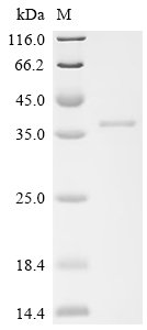 Recombinant Human Deoxyribonuclease-1-like 2 (DNASE1L2), Homo sapiens (Human), E.coli, N-terminal 10xHis-tagged and C-terminal Myc-tagged, 38.4kDa, purity >90% as determined by SDS-PAGE.