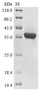 Recombinant Human Deoxyribonuclease gamma (DNASE1L3), Homo sapiens (Human), E.coli, N-terminal 10xHis-tagged and C-terminal Myc-tagged, 38.4kDa, purity >85% as determined by SDS-PAGE.