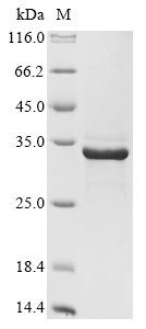 Recombinant Human Deoxyribonuclease gamma (DNASE1L3), Homo sapiens (Human), E.coli, Tag-Free, 33.4kDa, purity >85% as determined by SDS-PAGE.