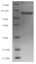 Recombinant Human DNA nucleotidylexotransferase (DNTT)