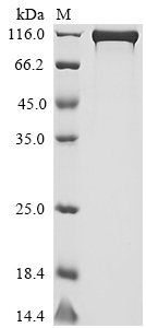 Recombinant Human Dipeptidyl peptidase 4 (DPP4), partial, Homo sapiens (Human), Mammalian cell, N-terminal hFc1-Flag-tagged and C-terminal Myc-tagged, 109.7kDa, purity >95% as determined by SDS-PAGE.