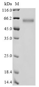 Recombinant Human Dihydropyrimidinase-related protein 3 (DPYSL3)