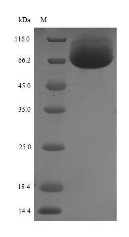 Recombinant Human Dihydropyrimidinase-related protein 5 (DPYSL5)