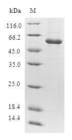 Recombinant Human Thymidylate kinase (DTYMK)