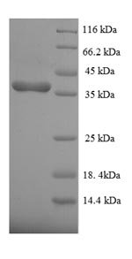 Recombinant Human Dual specificity protein phosphatase 26 (DUSP26)