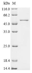 Recombinant Human Decapping and exoribonuclease protein (DXO), Homo sapiens (Human), E.coli, C-terminal 6xHis-tagged, 51.8kDa, purity >90% as determined by SDS-PAGE.