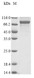 Recombinant Human Cytoplasmic dynein 1 intermediate chain 1 (DYNC1I1)