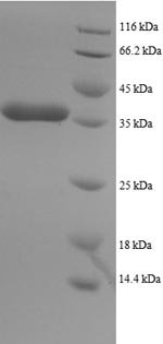 Recombinant Human Dynein light chain 1, Cytoplasmic domain (DYNLL1), Homo sapiens (Human), E.coli, N-terminal GST-tagged, 37.4kDa, purity >90% as determined by SDS-PAGE.