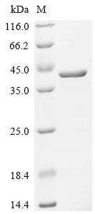Recombinant Human Delta (3,5)-Delta (2,4)-dienoyl-CoA isomerase, mitochondrial (ECH1)