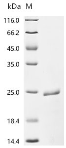 Recombinant Human Augurin(ECRG4), partial, Homo sapiens (Human), E.coli, N-terminal 6xHis-SUMO-tagged, 20.8kDa, purity >85% as determined by SDS-PAGE.