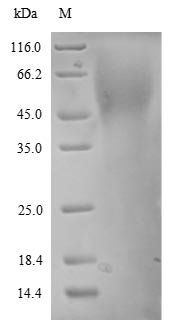 Recombinant Human Endothelin-1 receptor (EDNRA), partial, Homo sapiens (Human), Yeast, N-terminal 6xHis-tagged, 8.8kDa, purity >90% as determined by SDS-PAGE.