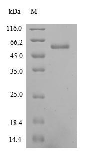 Recombinant Human Ephrin-A5 (EFNA5) (Active)