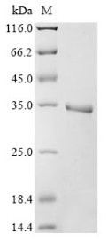 Recombinant Human Egl nine homolog 1 (EGLN1), partial, Homo sapiens (Human), E.coli, N-terminal 6xHis-tagged, 31.9kDa, purity >90% as determined by SDS-PAGE.