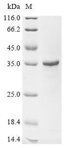 Recombinant Human Egl nine homolog 2 (EGLN2), Partial, Homo sapiens (Human), E.coli, N-terminal 6xHis-SUMO-tagged, 32.3kDa, purity >90% as determined by SDS-PAGE.