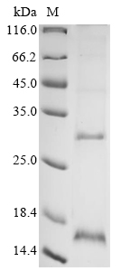 Recombinant Influenza A virus Matrix protein 2 (M) Protein, Influenza A virus (strain A/Puerto Rico/8/1934 H1N1), in vitro E.coli expression system, N-terminal 10xHis-tagged, 12.5kDa, purity >90% as determined by SDS-PAGE.