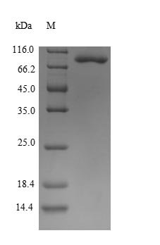 Recombinant Human Alpha-enolase (ENO1), partial