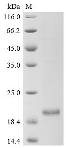 Recombinant Human Enhancer of yellow 2 transcription factor homolog (ENY2), Homo sapiens (Human), E.coli, C-terminal 6xHis-tagged, 18.4kDa, purity >90% as determined by SDS-PAGE.
