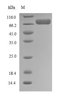 Recombinant Human Ephrin type-A receptor 3 (EPHA3), partial (Active), Homo sapiens (Human), Mammalian cell, C-terminal 6xHis-tagged, 61.0kDa, purity >95% as determined by SDS-PAGE.