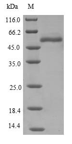 Recombinant Human Epoxide hydrolase 1 (EPHX1)