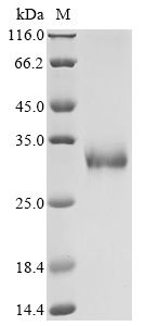 Recombinant Human Erythropoietin receptor (EPOR), partial