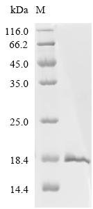 Recombinant Influenza A virus Matrix protein 2 (M) Protein, Influenza A virus (strain A/New Zealand:South Canterbury/35/2000 H1N1), in vitro E.coli expression system, C-terminal 6xHis-tagged, 11.9kDa, purity >95% as determined by SDS-PAGE.