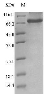 Recombinant Human Endogenous retrovirus group K member 6 Env polyprotein (ERVK-6), partial, Homo sapiens (Human), E.coli, N-terminal 6xHis-SUMO-tagged, 77.5kDa, purity >90% as determined by SDS-PAGE.