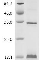 (Tris-Glycine gel) Discontinuous SDS-PAGE (reduced) with 5% enrichment gel and 15% separation gel.