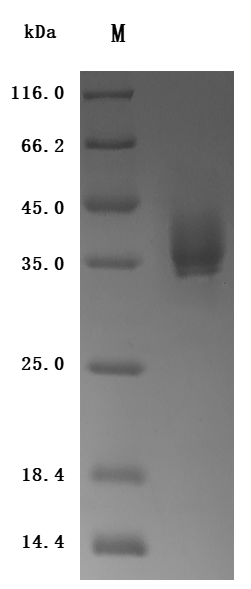 Recombinant Human Tissue factor (F3), partial (Active), Homo sapiens (Human), Mammalian cell, C-terminal 10xHis-tagged, 26.2kDa, purity >95% as determined by SDS-PAGE.